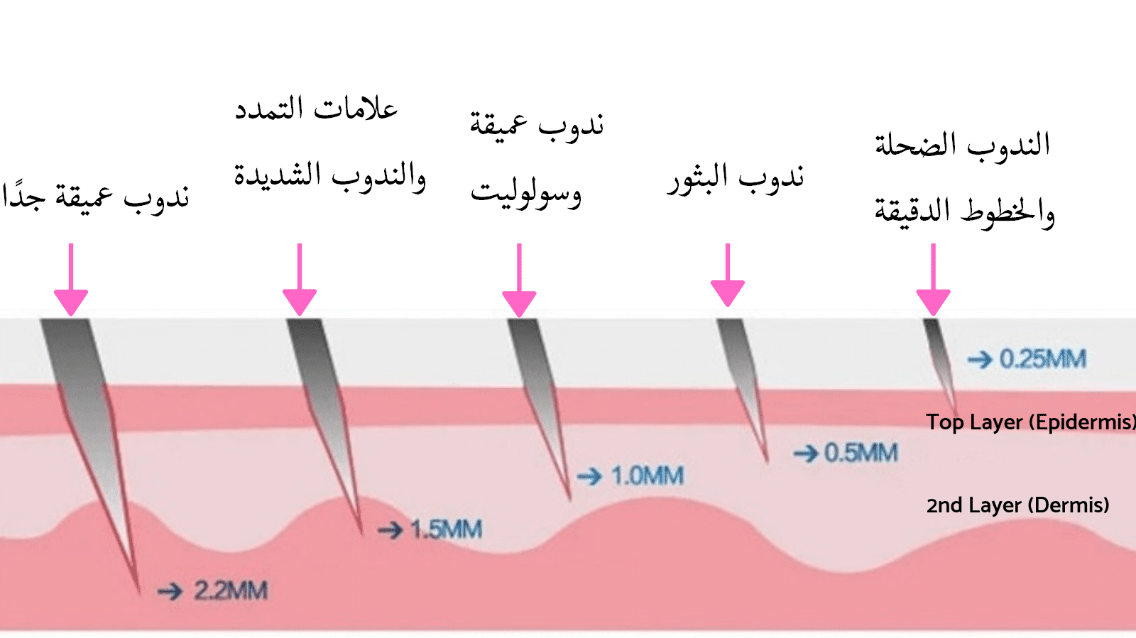 مقاسات جهاز ديرما رولر للوجه