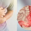 أفضل دواء لعلاج تقلصات القولون نهائيًا
